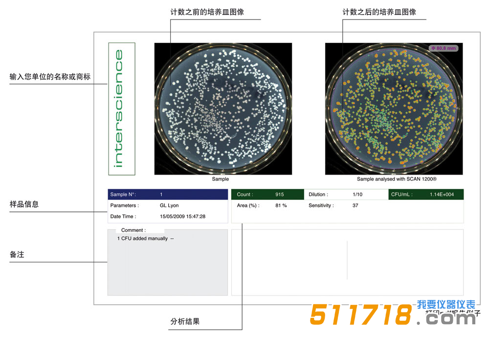 法国interscience Scan 300全自动菌落计数器2.png