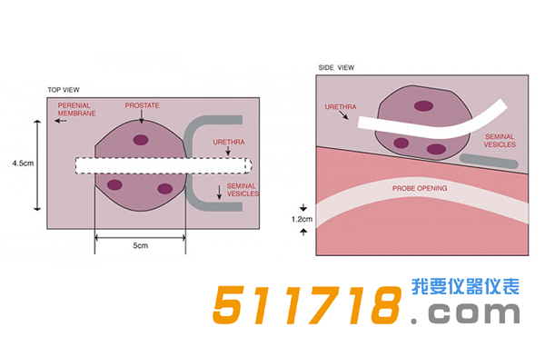 美国CIRS 053S 053L 053L-EF前列腺MRI测试体模2.png