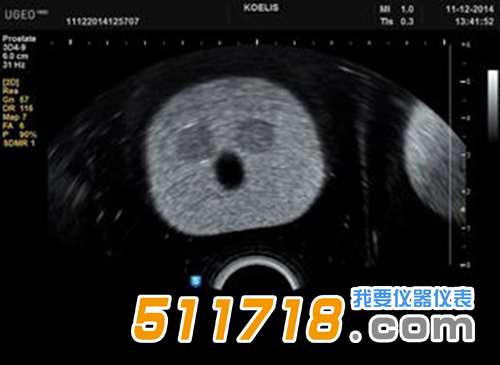 美国CIRS 053S 053L 053L-EF前列腺MRI测试体模3.png
